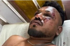 Passageiro sobrevive à queda de avião na Índia