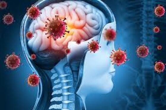 meningite.jpg