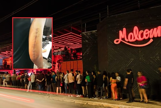 Braço Malcom Pub.png